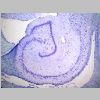 Neuronas Nissl 06.jpg